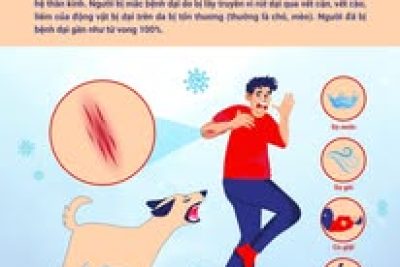 Bài tuyên truyền phòng, chóng bệnh Dại